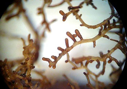 mycorrhiza_truffles